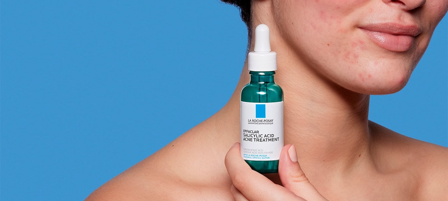 remedio para las espinillas